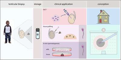 Spermatogonial Stem Cell-Based Therapies: Taking Preclinical Research to the Next Level